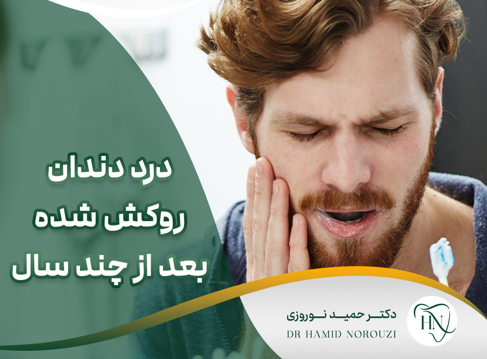 علت درد دندان روکش شده بعد از چند سال